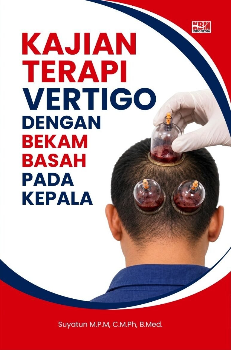 Kajian Terapi Vertigo dengan Bekam Basah pada Kepala